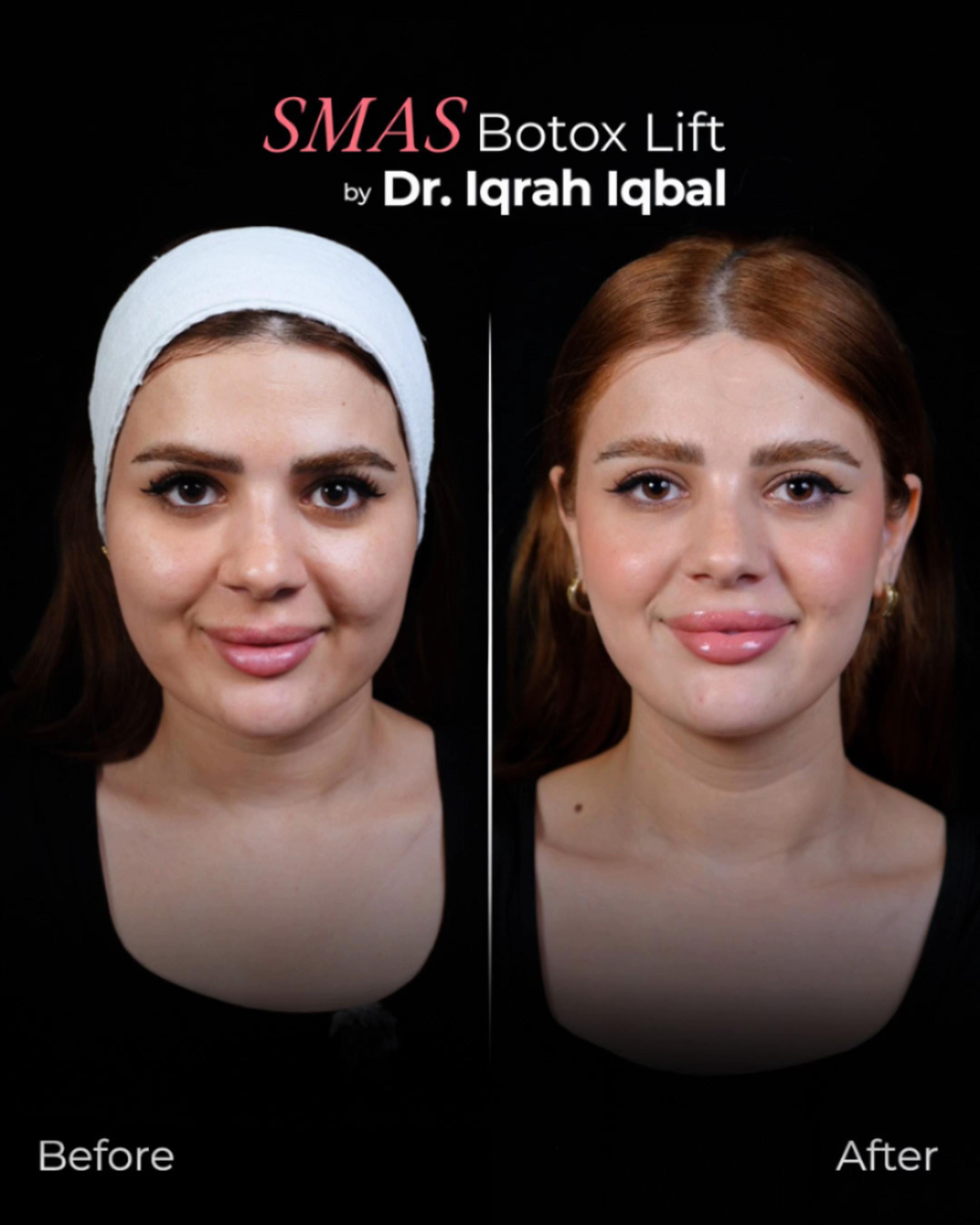 Post 3 by Dr.Iqrah.Aesthetics on TikTok (video)