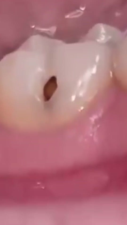 Post 5 by Dr Ibrahim Reda on TikTok (video)