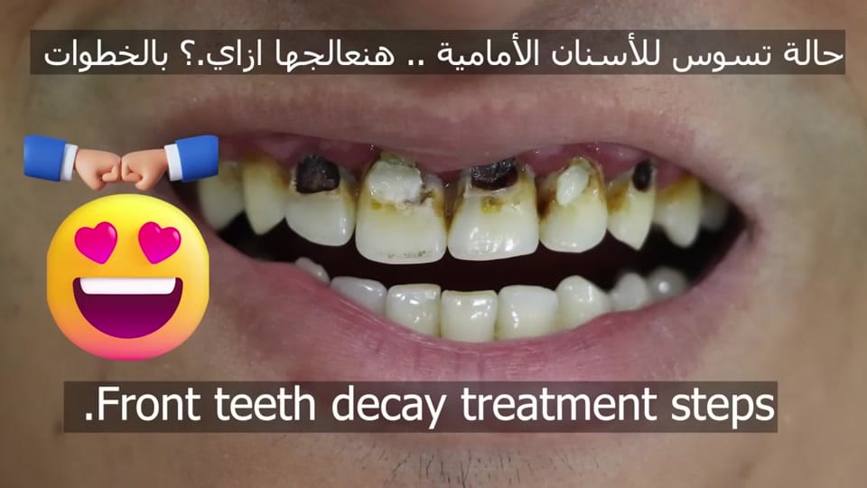 Post 4 by Dr Ibrahim Reda on TikTok (video)