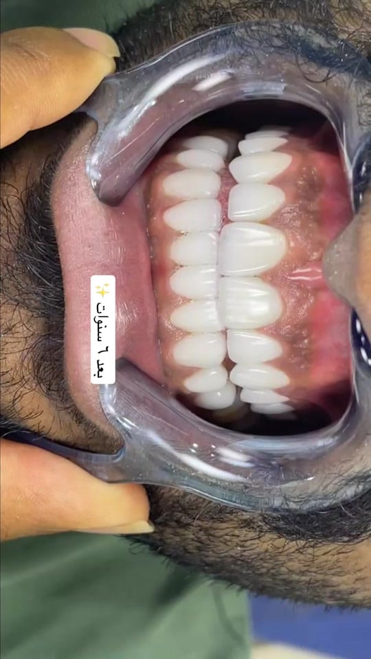 Post 6 by drkholoud on TikTok (video)