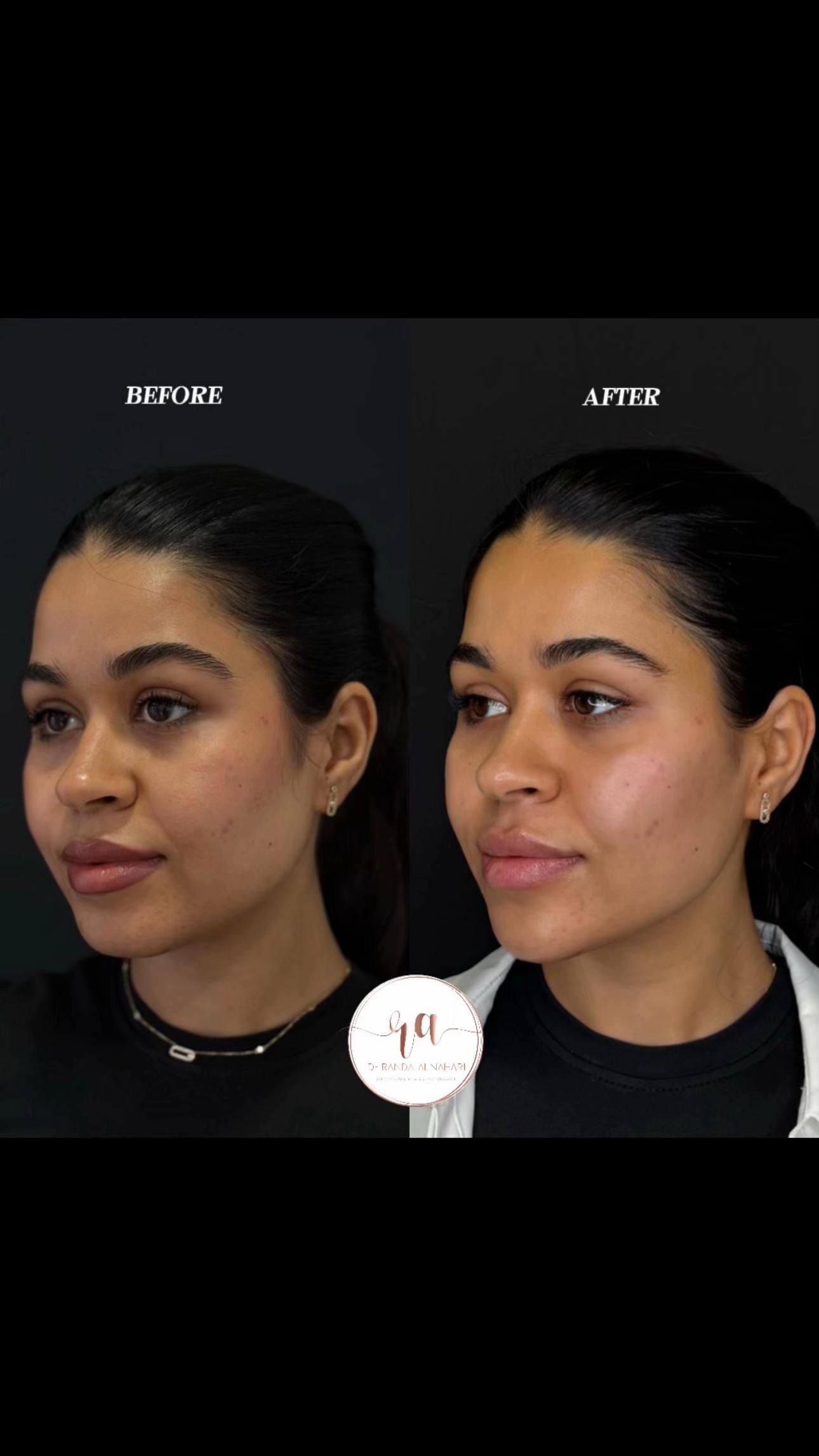 Post 2 by dr.fadhlnaji on TikTok (video)