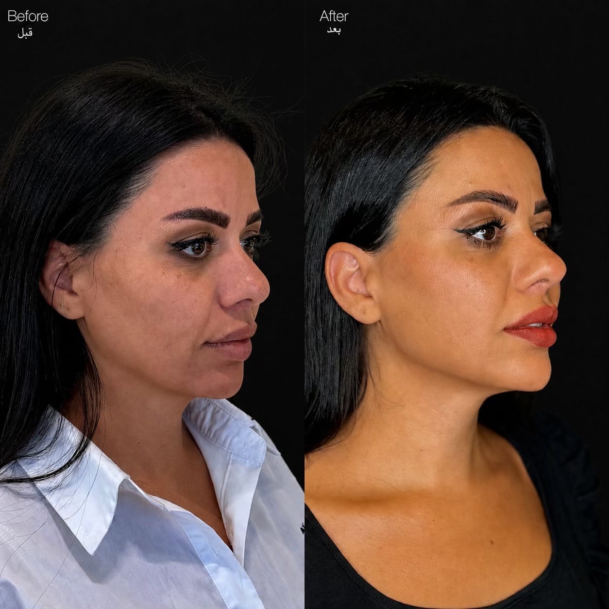 Post 4 by dr.fadhlnaji on TikTok (video)