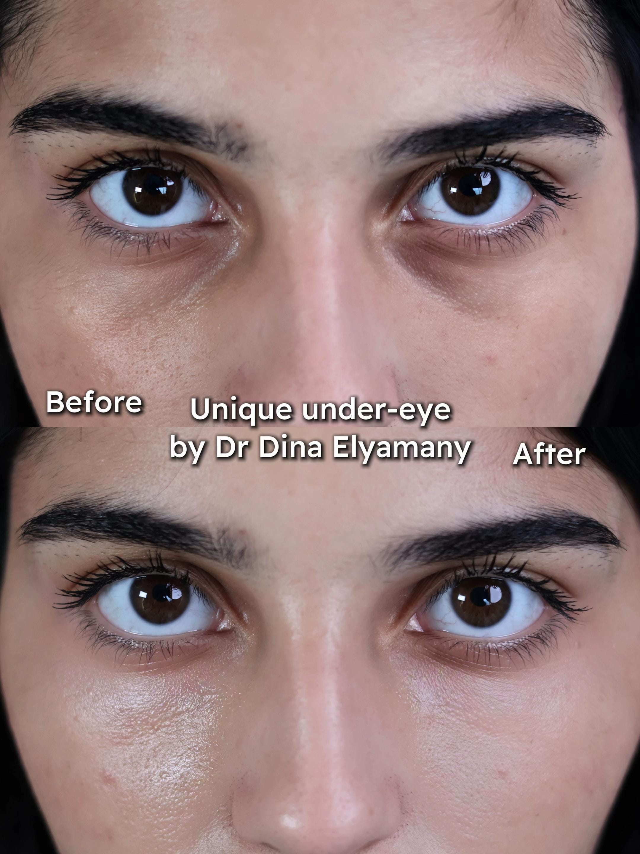 Post 7 by Dr Dina Elyamany on TikTok (video)