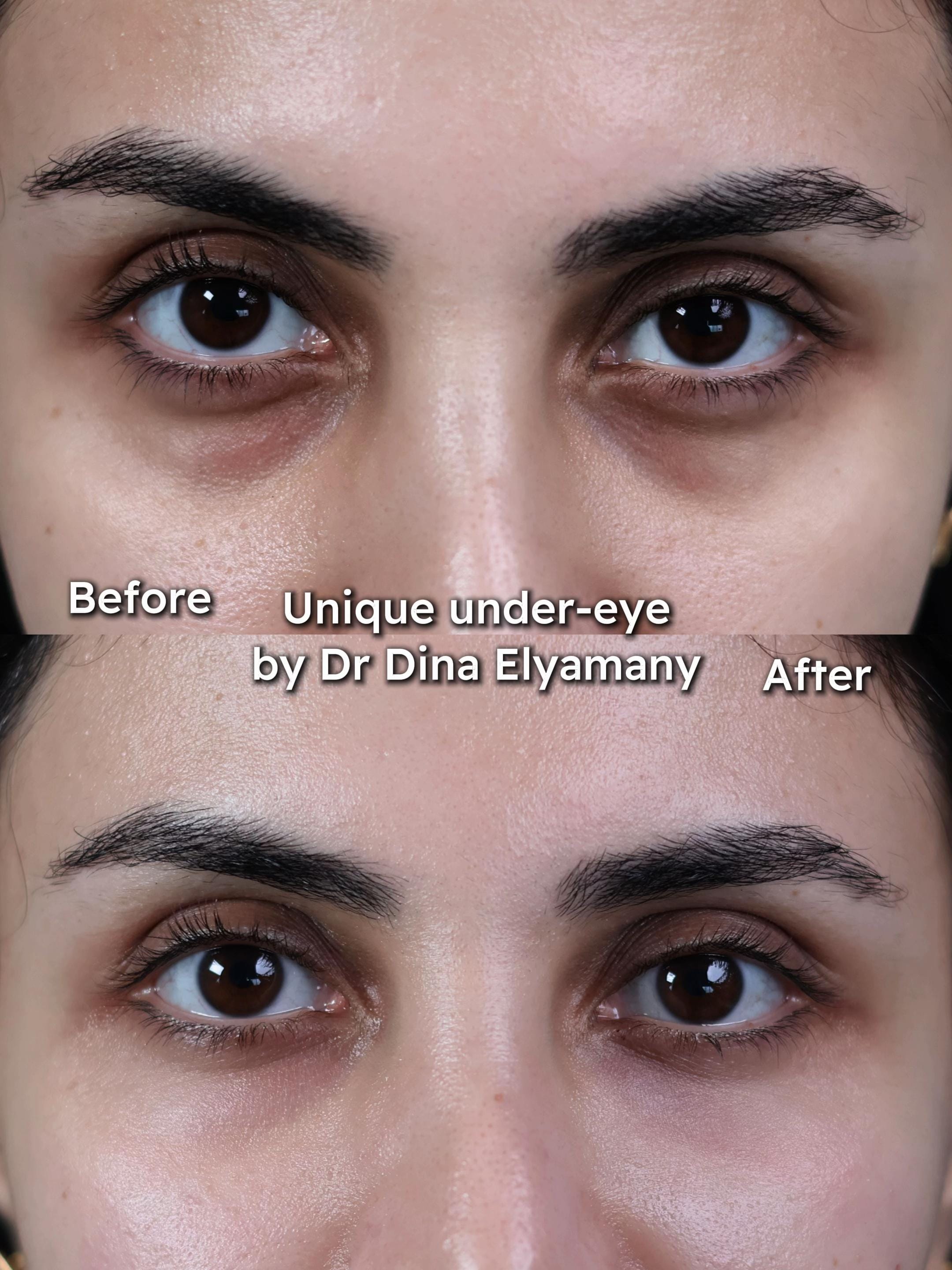 Post 5 by Dr Dina Elyamany on TikTok (video)