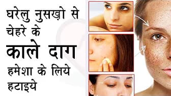 Post 2 by Dr. Healthify on YouTube (video)
