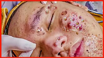 Post 3 by CalmSkin ASMR on YouTube (video)