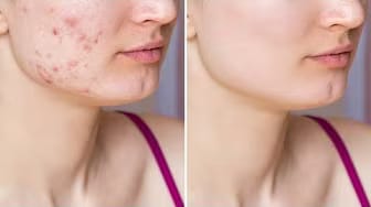 Post 8 by Healthy Life on YouTube (video)