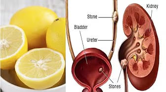 Post 2 by Herbs cures on YouTube (video)