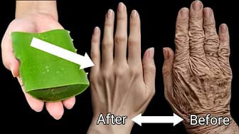 Post 1 by WellSpring health on YouTube (video)