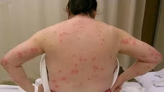 Post 5 by Side Effects Of on YouTube (video)