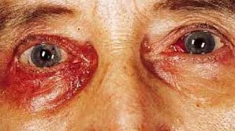 Post 8 by Side Effects Of on YouTube (video)