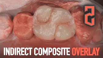 Post 1 by Dr Mohamed Sherif on YouTube (video)