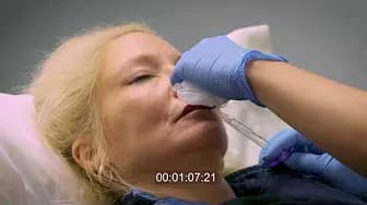Post 10 by Advanced Vein Care - David C. Faber, MD, FACS on YouTube (video)