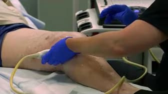 Post 3 by Advanced Vein Care - David C. Faber, MD, FACS on YouTube (video)