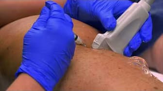 Post 2 by Advanced Vein Care - David C. Faber, MD, FACS on YouTube (video)