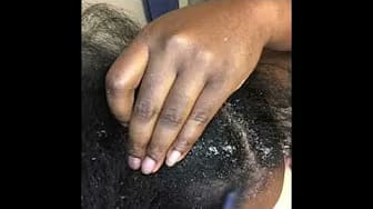 Post 3 by Nurse Flakes on YouTube (video)