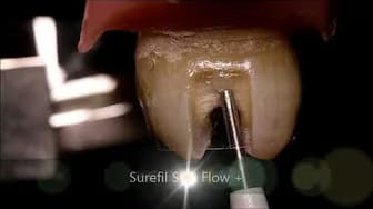Post 2 by Dentinaltube Channel on YouTube (video)
