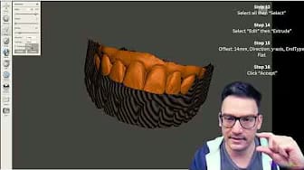 Post 1 by Dentinaltube Channel on YouTube (video)