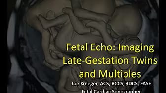 Post 5 by Joe Kreeger on YouTube (video)