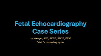 Post 6 by Joe Kreeger on YouTube (video)
