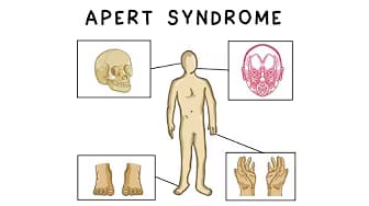 Post 4 by Learn Medical Genetics on YouTube (video)