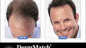 Post 3 by DermMatch Topical Shading on YouTube (video)