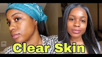 Post 9 by Kia3x on YouTube (video)