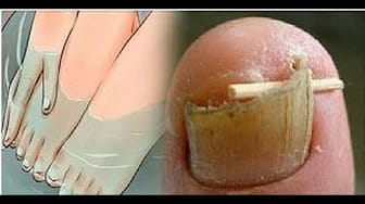 Post 8 by Escuela de Salud on YouTube (video)