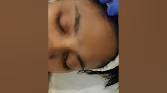 Post 9 by About Face Aesthetics Center on YouTube (video)