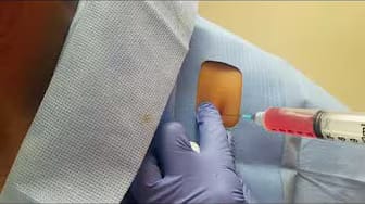 Post 8 by About Face Aesthetics Center on YouTube (video)