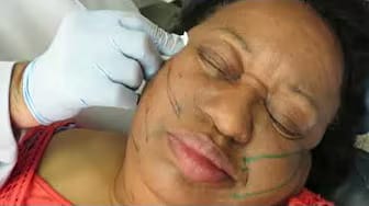 Post 3 by About Face Aesthetics Center on YouTube (video)