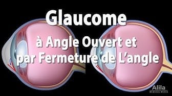 Post 9 by Alila Medical Media en Français on YouTube (video)