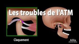 Post 2 by Alila Medical Media en Français on YouTube (video)