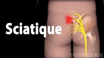 Post 1 by Alila Medical Media en Français on YouTube (video)