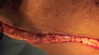 Post 5 by Dr. Amy Bandy on YouTube (video)