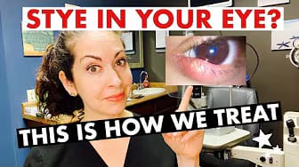 Post 2 by The Eye Surgeon on YouTube (video)