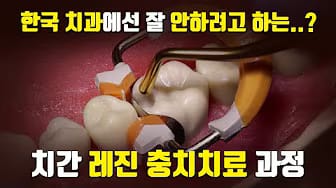 Post 9 by 빈치의 치과치료 과정 on YouTube (video)