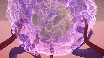 Post 8 by Bethea Medical Media on YouTube (video)
