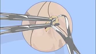 Post 1 by Bethea Medical Media on YouTube (video)
