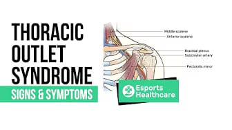 Post 9 by Esports Healthcare on YouTube (video)