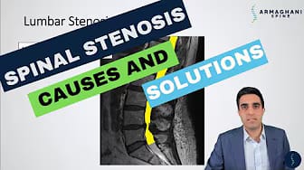 Post 8 by Armaghani Spine on YouTube (video)