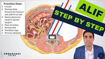 Post 10 by Armaghani Spine on YouTube (video)