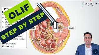 Post 7 by Armaghani Spine on YouTube (video)