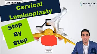 Post 6 by Armaghani Spine on YouTube (video)