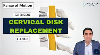 Post 2 by Armaghani Spine on YouTube (video)