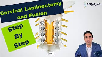 Post 1 by Armaghani Spine on YouTube (video)