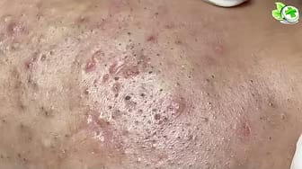 Post 2 by Holistic Natural Cure on YouTube (video)