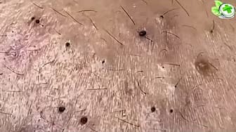 Post 1 by Holistic Natural Cure on YouTube (video)