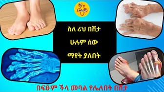 Post 1 by የኔ ሐኪም | Yene Hakim on YouTube (video)