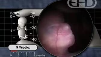 Post 7 by ehdvideos on YouTube (video)